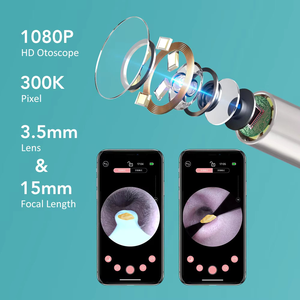 Smart Wi-Fi Visual Earwax Cleaner & Tweezer Set with 1080P HD Otoscope Camera
