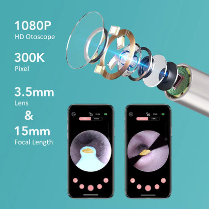 Smart Wi-Fi Visual Earwax Cleaner & Tweezer Set with 1080P HD Otoscope Camera